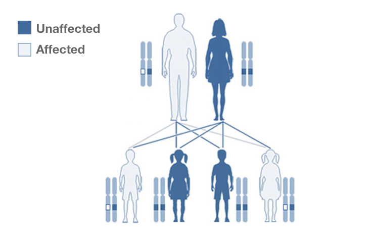 what-is-an-example-of-a-genetic-disease