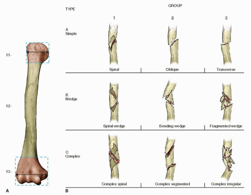 the humerus is an example of what type of bone